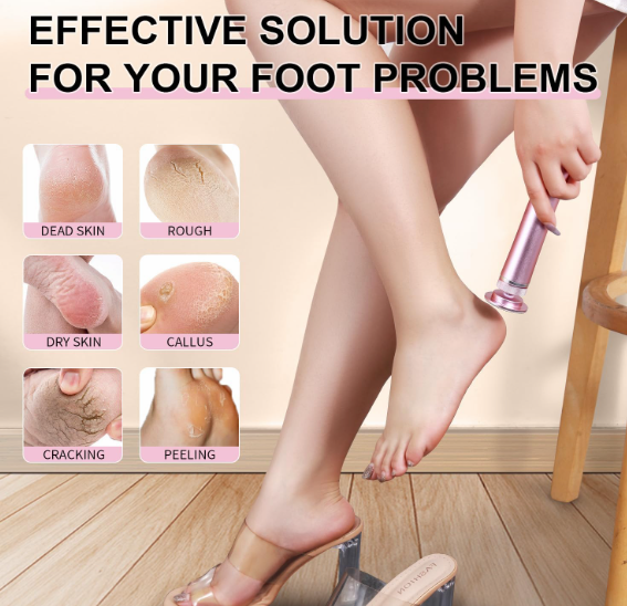 Smooth Steps Feet Callus Remover | 30 FREE Sandpaper disks included
