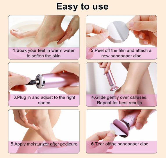 Smooth Steps Feet Callus Remover | 30 FREE Sandpaper disks included