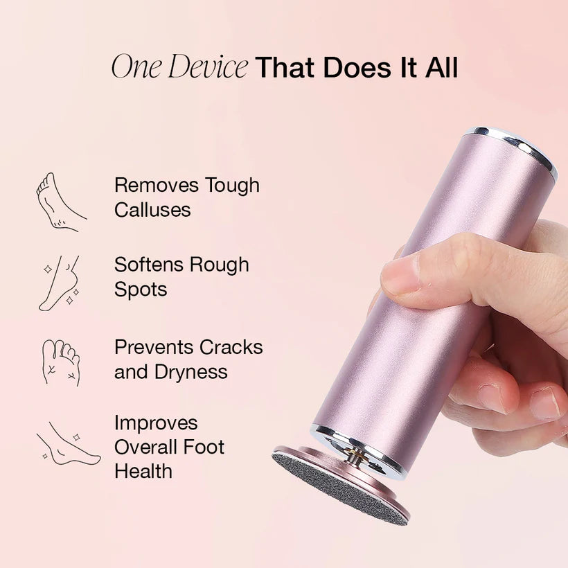 Smooth Steps Feet Callus Remover | 30 FREE Sandpaper disks included