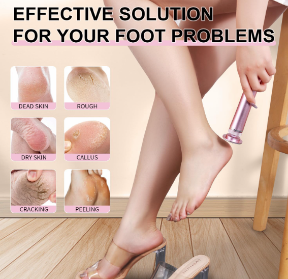 Feet Callus Remover | 30 FREE Sandpaper disks included